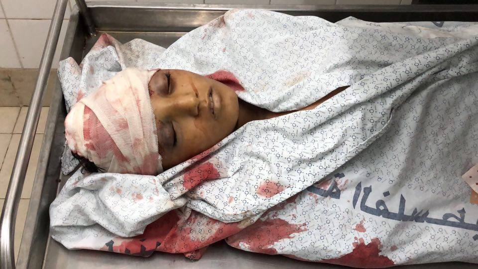شهيدان برصاص الاحتلال في جمعة “أطفالنا الشهداء” بغزة